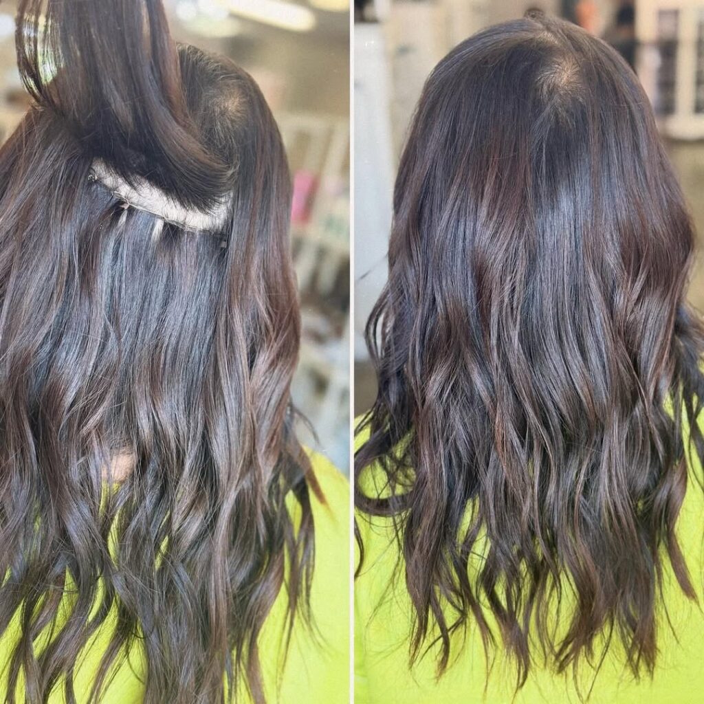 Struggling with hair loss from postpartum changes, alopecia, rapid weight loss, or other causes